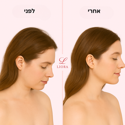 מברשת ליורה  4 ב־1 לטיפול בצמיחת שיער